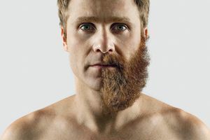 Кому нужен триммер? Кому нужен триммер?